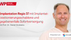 OP zum Thema „Implantation Regio 37 mit Positionierungsschablone”