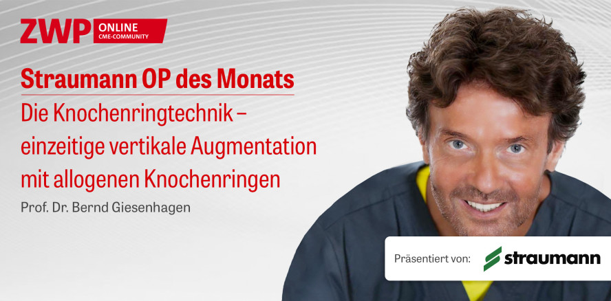 1 CME-Punkt: Straumann-OP zur Knochenringtechnik im Archiv
