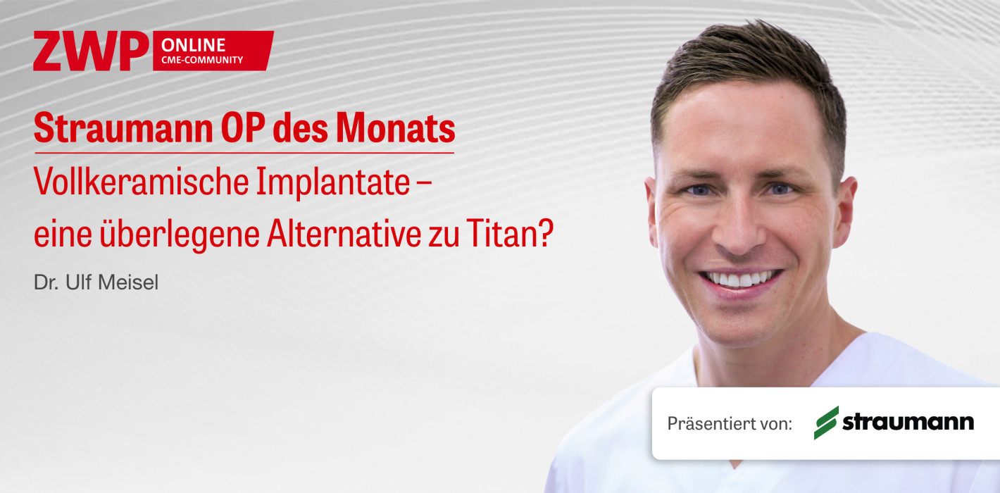 Tutorial zu vollkeramischen Implantaten: Jetzt im Archiv
