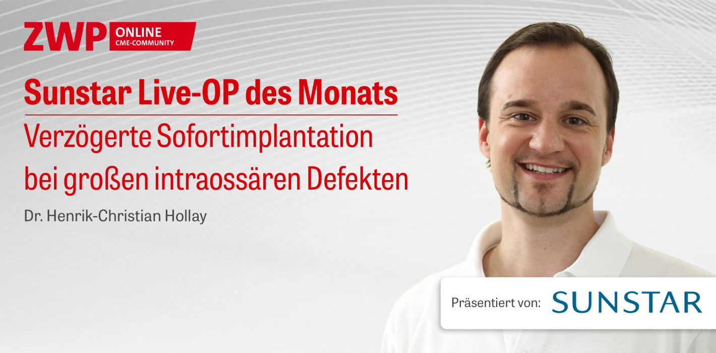 Im Archiv abrufbar: Sunstar Live-OP mit Dr. Henrik-Christian Hollay