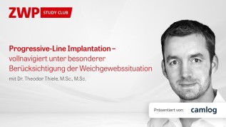 PROGRESSIVE-LINE Implantation – vollnavigiert unter besonderer Berücksichtigung der Weichgewebssituation