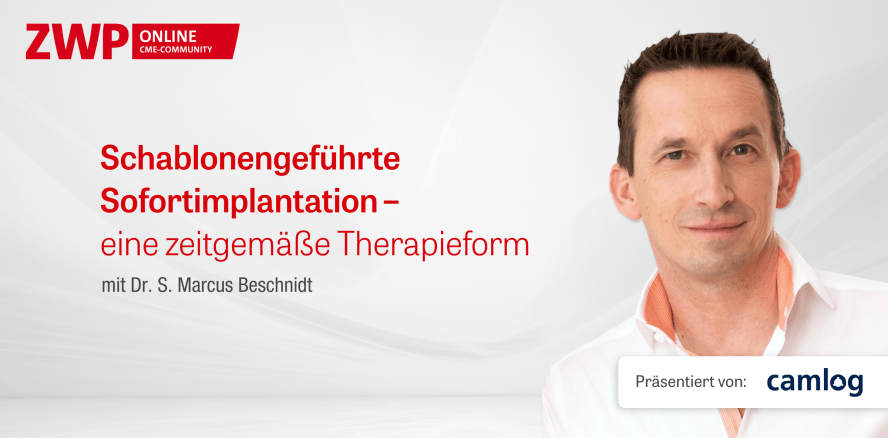 CAMLOG-OP: Schablonengeführte Sofortimplantation