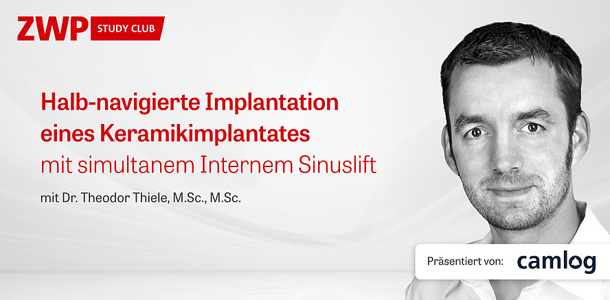 Jetzt im Archiv: Live-OP mit Dr. Thiele zu halb-navigierter Implantation eines Keramikimplantates