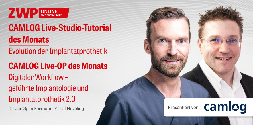 2 CME-Punkte: CAMLOG Live-Studio-Tutorial & Live-OP im Archiv