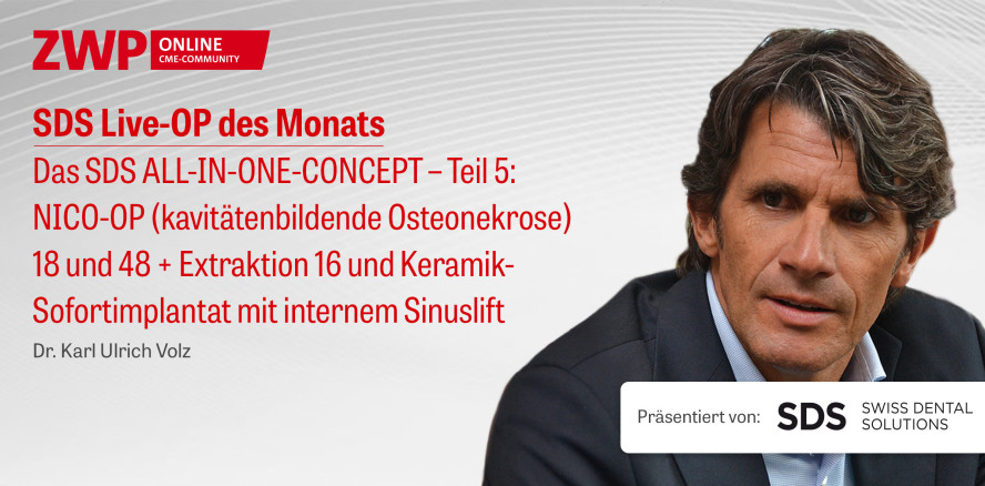 1 CME-Punkt: Live-OP „Das SDS ALL-IN-ONE-CONCEPT – Teil 5“ im Archiv