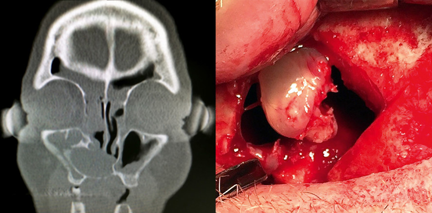 Digitale Volumentomografie versus Computertomografie