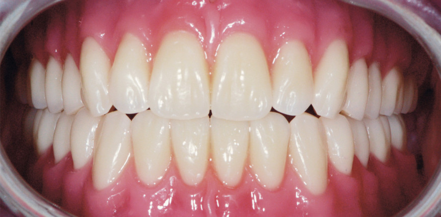 Mit der Dritten sieht man besser!