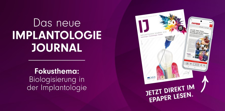 IJ-Septemberausgabe: Biologisierung in der Implantologie