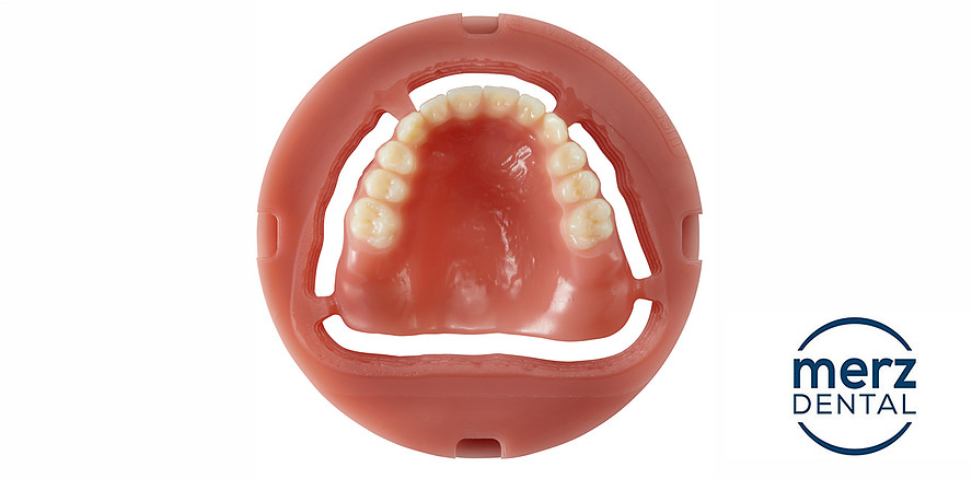 M-DENTURE entlastet Labore bei der digitalen Totalprothetik