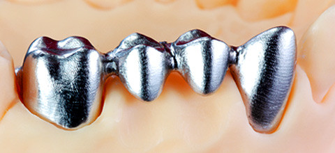 Edelmetallfreie Legierungen und Reintitan