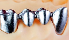 Edelmetallfreie Legierungen und Reintitan