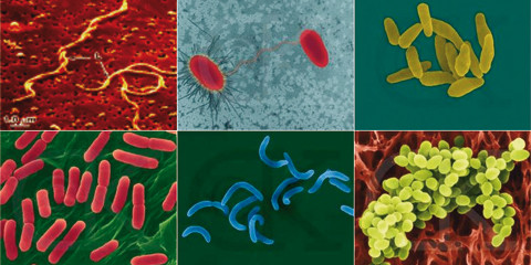 Biofilmmanagement mit Laser