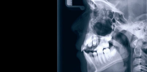 Die Bedeutung des Kiefergelenkes