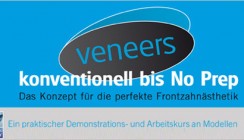 veneers von konventionell bis No Prep