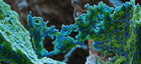 BASF bekämpft Karieserreger mit Milchsäurebakterien