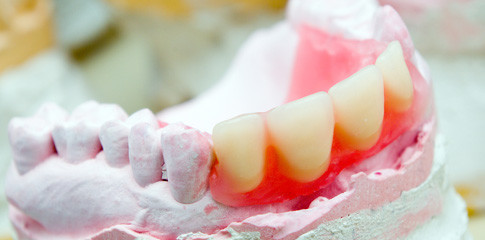 Umsätze im Zahntechniker-Handwerk stagnieren - Rückläufige Nachfrage durch Wirtschaftskrise