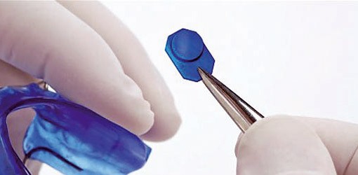 TheraMon® - die Innovation zur Dokumentation von Tragezeiten herausnehmbarer KFO-Apparaturen