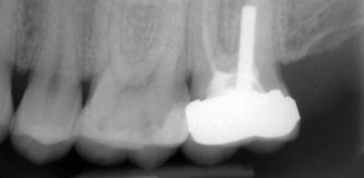 Endodontische Diagnostik und Behandlungsplanung
