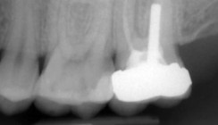 Endodontische Diagnostik und Behandlungsplanung