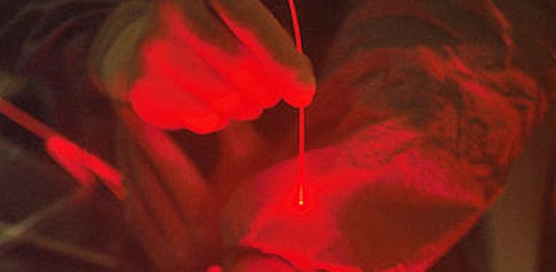 Neuer Ansatz in der Photodynamischen Therapie