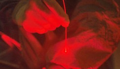 Neuer Ansatz in der Photodynamischen Therapie
