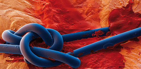 Von der biologischen Basis zum klinischen Erfolg