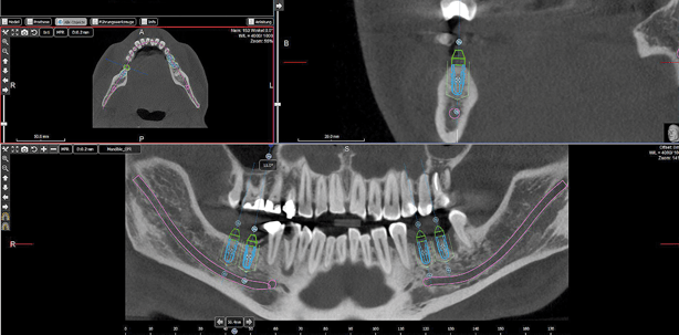 Open 3-D-Navigation und 3-D-Modellierung – Vision oder Mission?