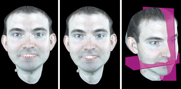 3-D-Planung mit der priti®imaging-Software