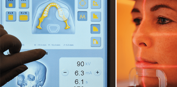 Metallartefaktreduktion in neuester 3-D-Röntgentechnologie