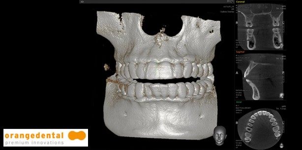 Fachdental Leipzig: 3-D-Röntgen für jede Praxis