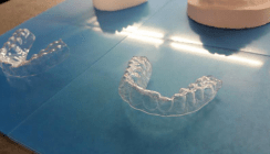3-D-Drucker statt Zahnarzt: Student bastelt sich Spangen selbst