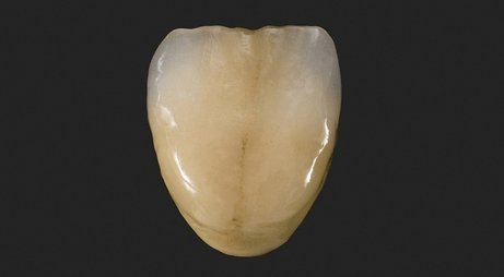 Zwei Standards für die Zukunft?