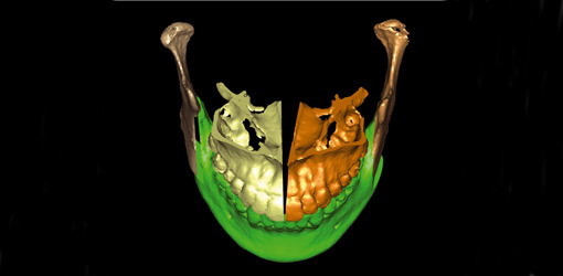 Die digitale Volumentomografie in der oralchirurgischen Praxis