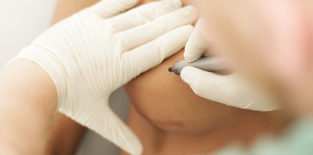 Verbot für Schönheitsoperationen bei Minderjährigen