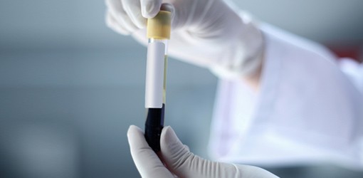 Personalisierte Medizin für präzise Diagnosen