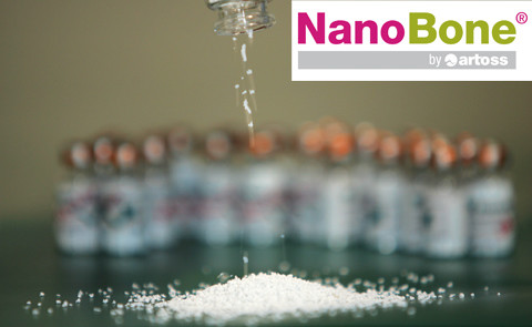 NanoBone® – Das Knochenaufbaumaterial
