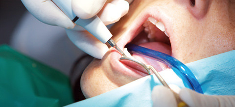 Professionelle Prophylaxe - Angebote der Praxen