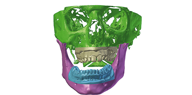 Greifbar nah: Die 4. Dimension der Kieferrelationsbestimmung
