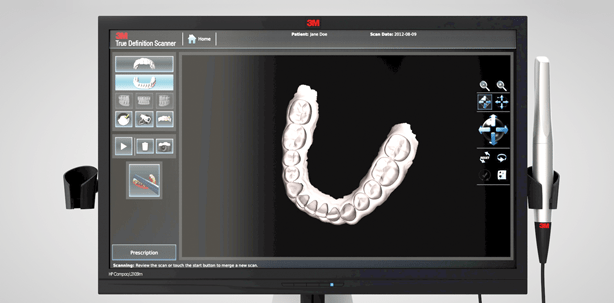Die perfekte Abformung für den perfekten Eindruck