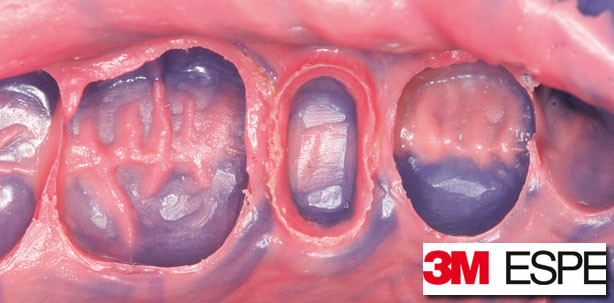 50 Jahre Impregum Polyether: Dem macht keiner was vor!