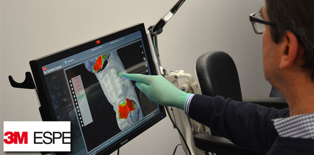 Digitale Abformung: Experten bringen Licht ins Dunkel