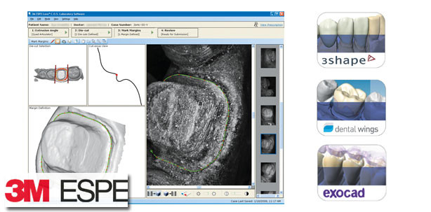 3M ESPE präsentiert neuen 3M True Definition Scanner