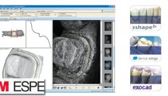 3M ESPE präsentiert neuen 3M True Definition Scanner