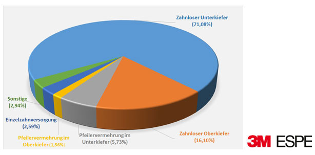 Minimaler Durchmesser, maximale Zufriedenheit!