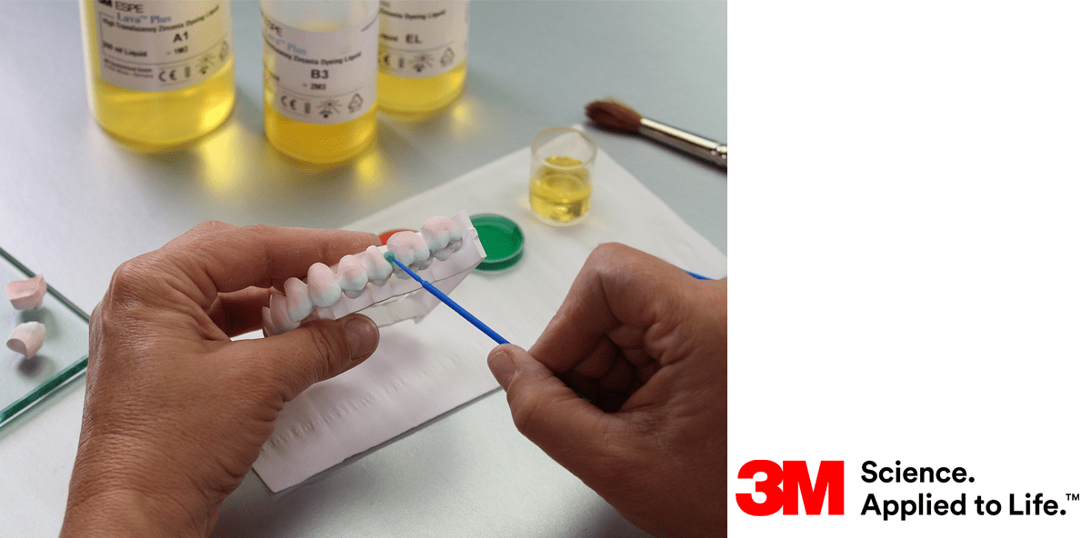 3M gewinnt Patentklage gegen Dental Direkt
