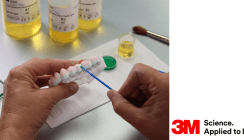 3M gewinnt Patentklage gegen Dental Direkt