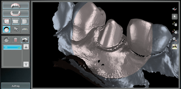 Einen Intraoralscanner in den Praxisalltag integrieren