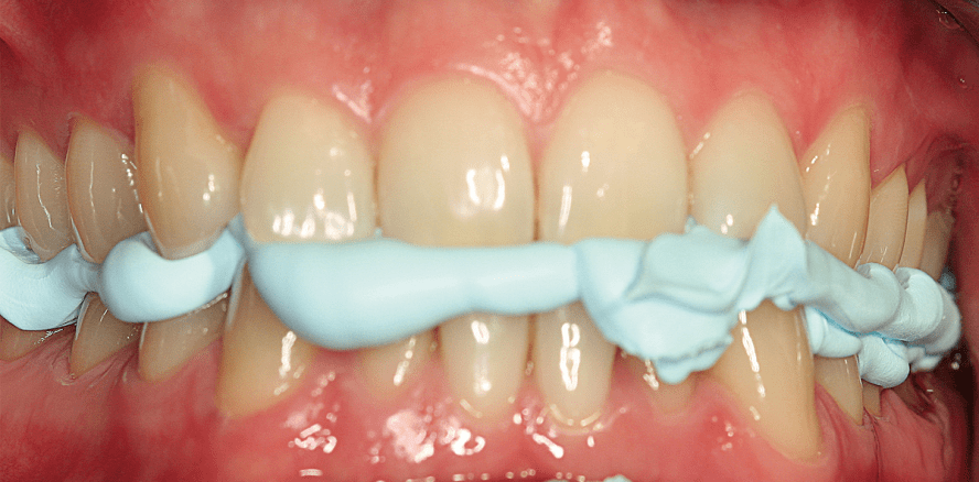 Versorgungstherapie: Standardisierung im Dienste der Vorhersagbarkeit