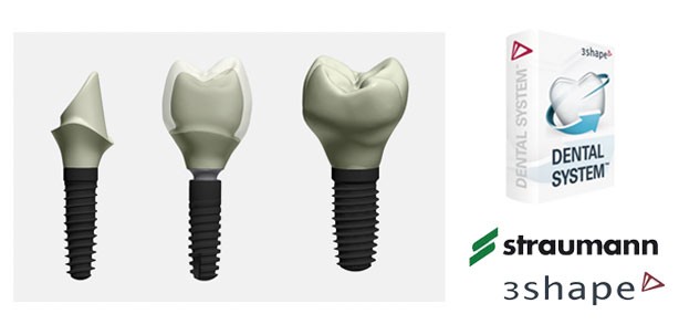 3Shape und Straumann: Software - Erweiterung von Dental System™