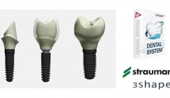 3Shape und Straumann: Software - Erweiterung von Dental System™